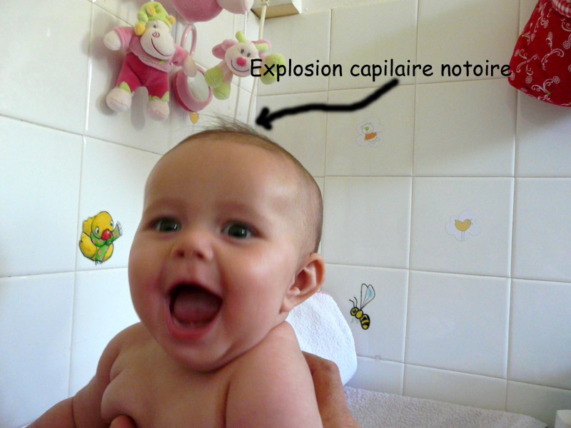 Explosion capilaire copier